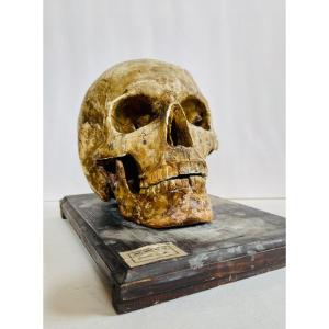 Human Skull 